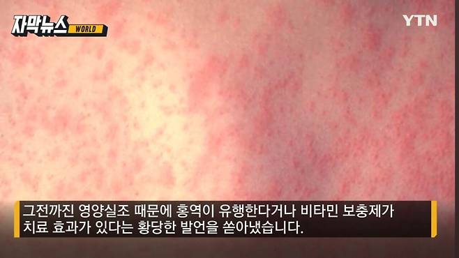 백신 주사가 자폐증의 원인?