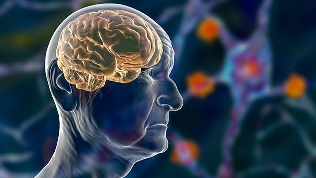 파킨슨병의 대표 증상은 떨림, 경직, 구부정한 자세, 자세 불안정 등이다｜출처: 클립아트코리아