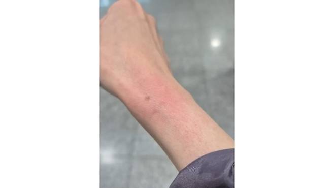 어제(16일) 권성동 국민의힘 원내대표가 국회에서 여성 기자의 손목을 붙잡아 피부가 붉게 변한 모습 (사진, 뉴스타파 유튜브 캡처)