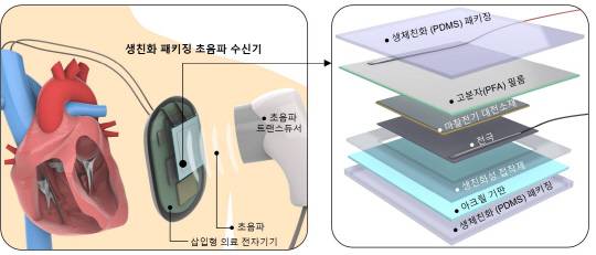 KIST가 개발한 생체 친화적 초음파 수신기 개념도 및 내부 구성도.