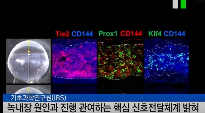 IMG_4242.jpeg 의학관련 신기술은 조금 걸러들어야되는 이유 ㅎㄷㄷㄷㄷ