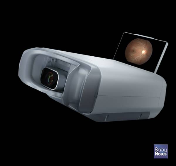 안저카메라.&nbsp;ⓒ아크