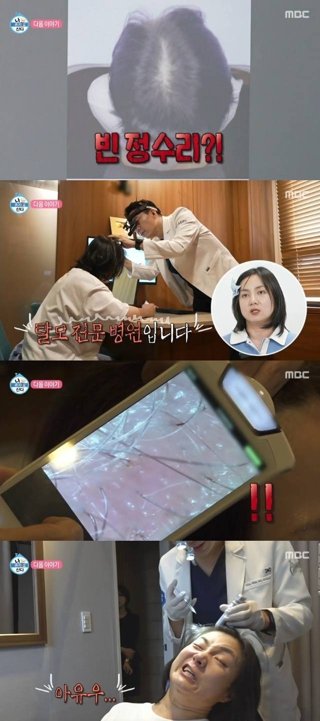 박나래가 남성형 탈모 진단에 충격을 받았다.&nbsp; MBC ‘나 혼자 산다’ 방송화면 캡처