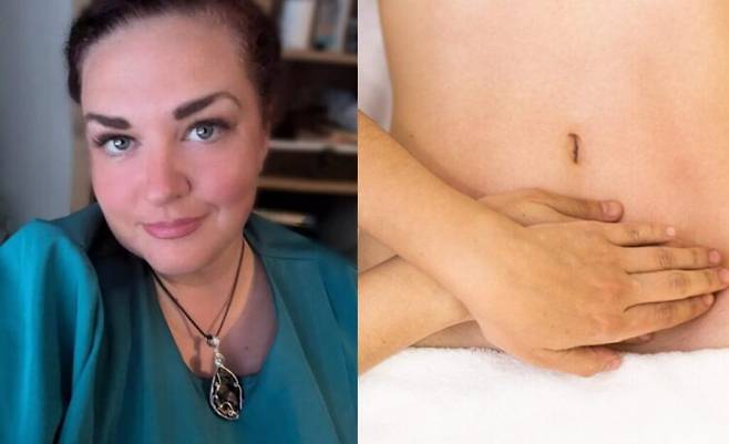 배꼽에서 피가 나오는 증상을 겪은 후 예상치 못한 진단을 받은 여성의 사연이 소개됐다. [사진=SNS / 우측 배꼽=게티이미지뱅크]