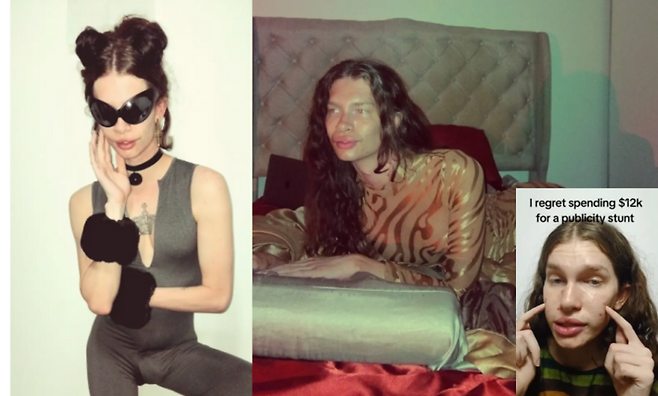 콧구멍을 넗히고 광대를 툭 튀어나오게, 고양이 얼굴처럼 보이기 위해 여러 실험적 시술을 받았던 한 틱톡커가 뒤늦게 후회 중이라는 사연이 공개됐다.[사진=SNS]