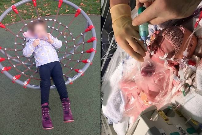 선청성 희귀 질환 심장외위증을 가지고 태어난 영국의 바넬로피 호프 월킨스(7)가 수술을 받고 건강을 회복하고 있다. 사진=바넬로피 호프 월킨스 페이스북/글렌필드 병원