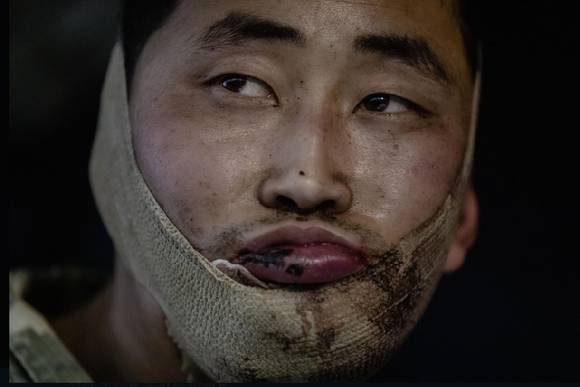 러시아·우크라이나 전쟁에 파병된 북한군 가운데 무려 600여 명의 사망자를 포함해 4700여 명의 사상자가 발생했다. 사진은 우크라이나군에 생포된 북한군 병사. [사진=젤렌스키 X]