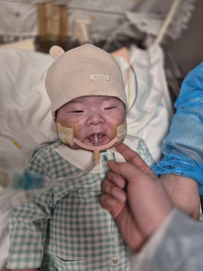 지난 2월 경기도 성남시 분당서울대병원 중환자실에 입원해 있는 윤솔(0)군의 볼을 만지고 있는 엄마의 손가락. 안지은씨 제공