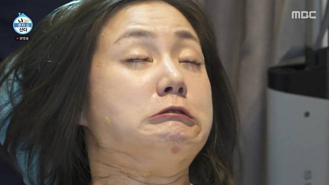 박나래가 두피에 주사를 맞으며 괴로워하고 있다. /사진=MBC '나 혼자 산다' 캡처