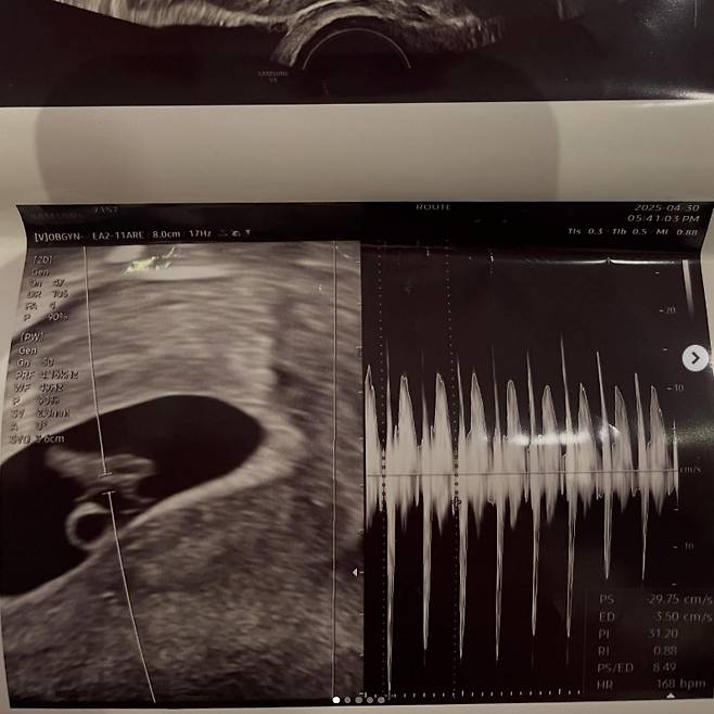 /사진=서민재 SNS