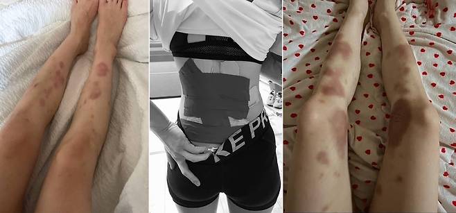 스턴트치어리더의 일상 (인천=연합뉴스) 화려한 치어리딩 기술은 하루아침에 완성되지 않는다. 피멍이 가실 날이 없고 허리에 파스가 떨어질 날이 없을 정도로 강도 높은 연습이 수반되야 한다. 2025.5.3  
[문은비씨 제공, 재판매 및 DB 금지]