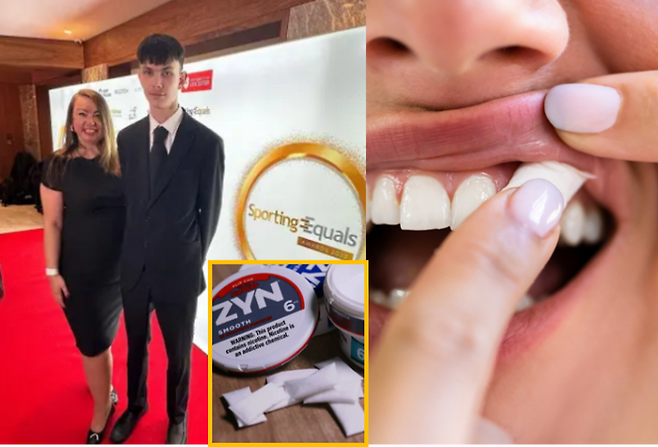 최근 SNS와 프리미어리그 축구 스타들의 영향으로 해외 청소년들 사이에서 니코틴 파우치(Zyn) 사용이 빠르게 확산되고 있다. PR 컨설턴트 켈리 화이트헤드(47)는 10대 아들이 니코틴 파우치에 흥미를 보이자 위험성을 알려주기 위해 직접 체험해봤다. [사진=왼쪽-SNS/우측 =게티이미지뱅크]