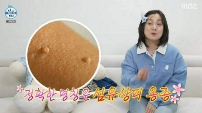 박나래가 쥐젖으로 인한 고민을 토로했다. [사진= MBC 예능프로그램 '나 혼자 산다' 방송화면 캡처]