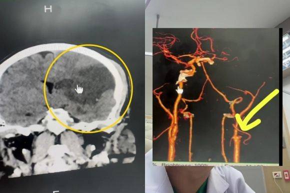 ⓒ전문의 SNS 갈무리