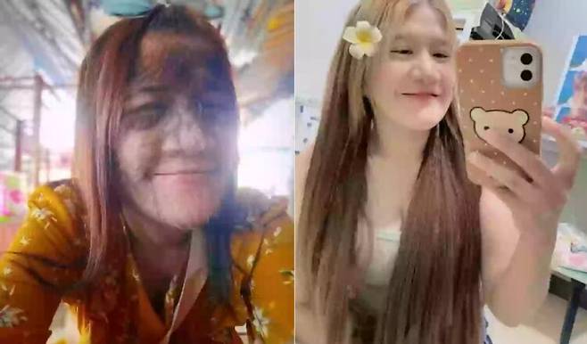 '늑대소녀'라 불리던 20대 태국 여성이 최근 털을 모두 없앤 근황이 화제다. [사진=SNS]
