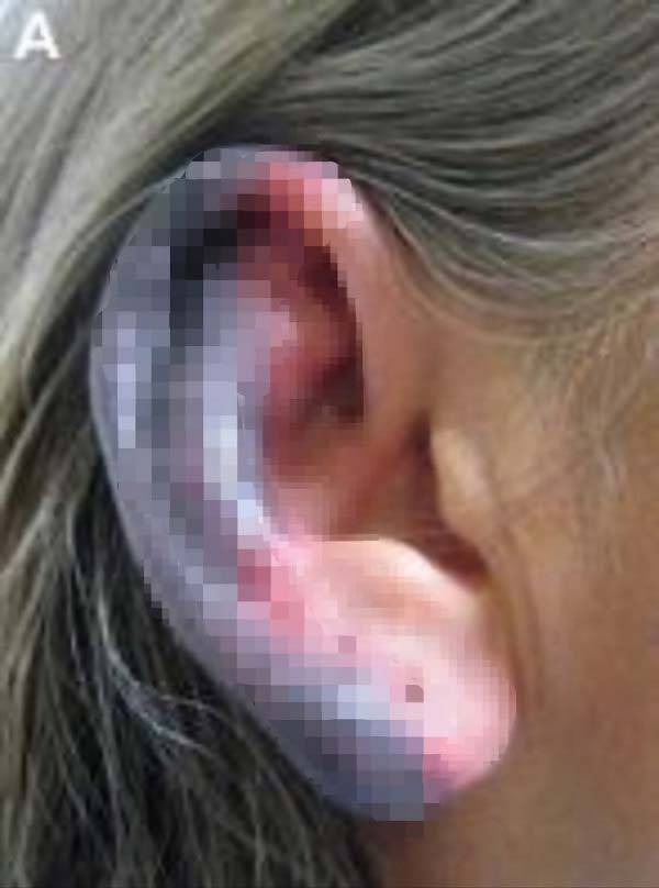 외국의 한 50대 여성이 지속적으로 코카인(독성과 중독성이 강한 마약 종류)을 흡입했다가, 부작용을 겪게 된 사례가 공개됐다./사진=캐나다 의학 협회지​