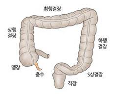 충수 위치와 형태.