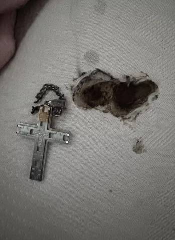 미국의 한 10대 소년이 침대에서 휴대폰을 충전하고 자던 중 감전당하는 사고를 당했다. [미러]