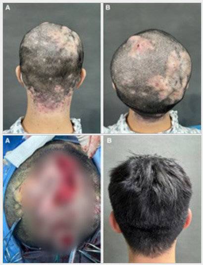 출처=‘성형외과 및 재건외과 글로벌 오픈’(PRS)