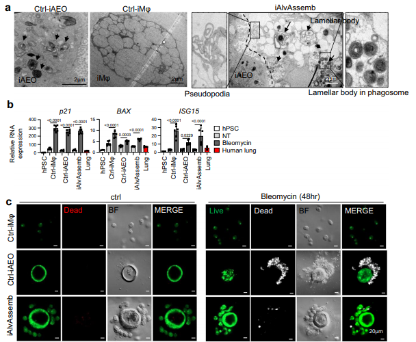 폐 어셈블로이드 대식작용 기능분석