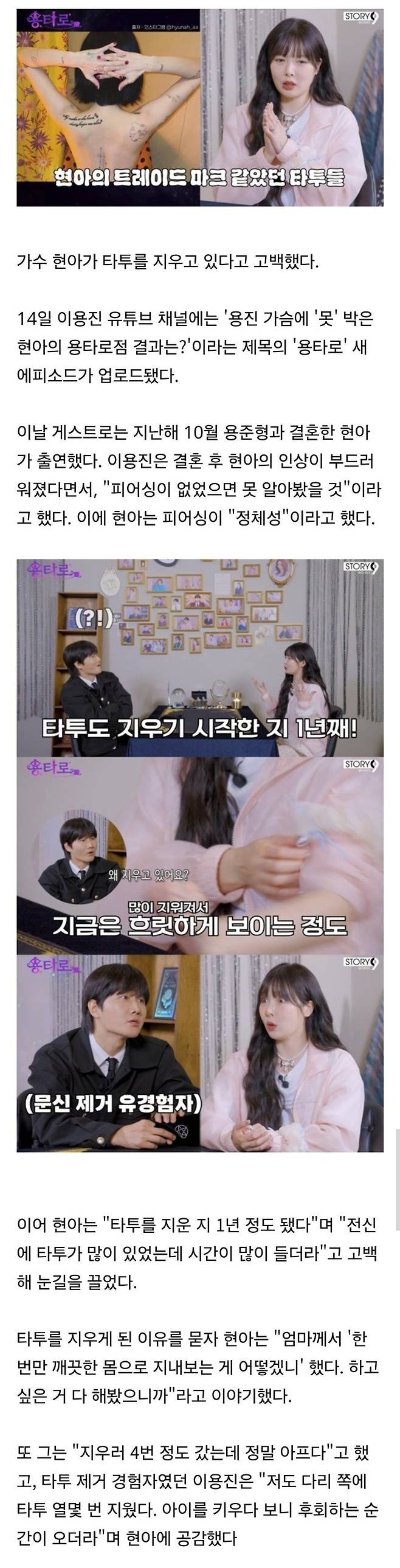 온몸을 문신으로 도배했던 현아가 제거 시술 받는 이유