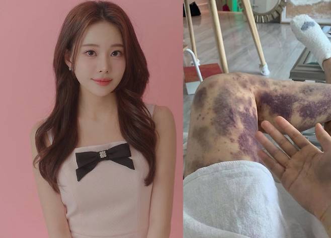 (사진=아옳이 SNS 캡처)