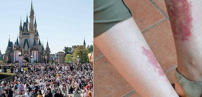 디즈니랜드 등 놀이동산을 장시간 걸을 때 피부에 발진이 생길 수 있다. 출처=게티이미지뱅크