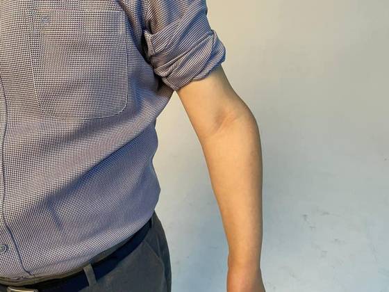 Lee Jae-myung's left arm was injured while working at a factory when he was young. The picture was released in 2021 on Lee's Facebook page. [SCREEN CAPTURE]