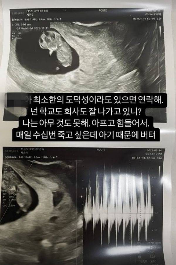 사진=서민재 SNS