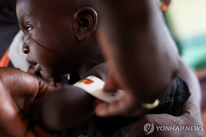 영양실조 치료받는 어린이 [로이터=연합뉴스 자료사진. 재판매 및 DB 금지]