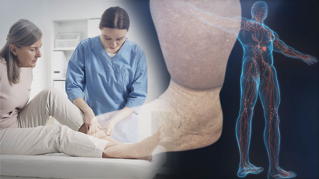 32화 이노메디&nbsp;