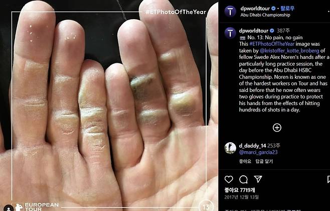 DP 월드 투어 소셜팀이 2017년 SNS에 게시한 사진 속 알렉스 노렌의 손에 굳은살이 박여 있다. SNS 캡처