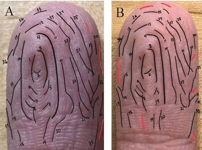 물에 오래 있다보면 손가락과 발가락이 쭈글해진다. 이러한 현상이 자율신경계의 작용과 혈관 수축으로 인해 생긴다는 사실을 실험을 통해 밝혀졌다. [사진=Journal of the Mechanical Behavior of Biomedical Materials]