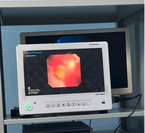 의료진은 초음파 검사를 통해 방광결석을 확인했다. [사진 = drthalesandrade 인스타그램]