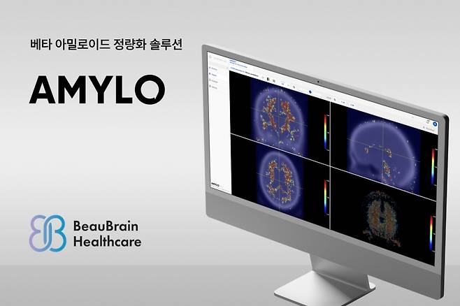 Amylo 관련 이미지./사진제공=뷰브레인헬스케어