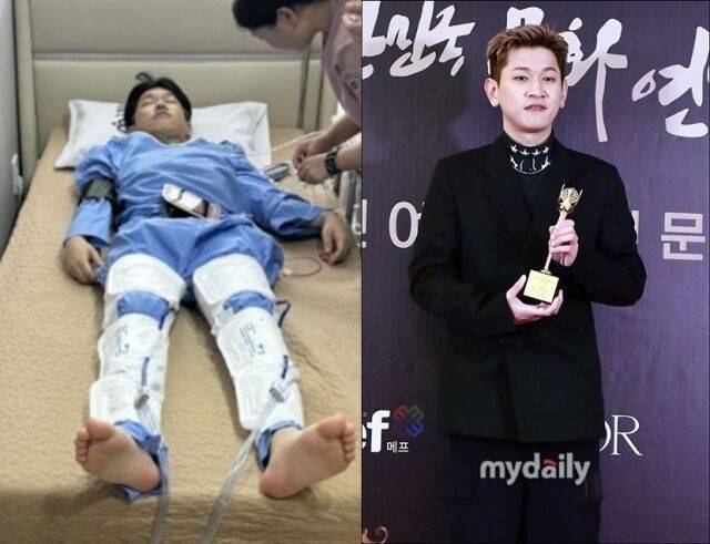 가수 크러쉬가 허리디스크 수술 당시 모습을 공개했다. / 크러쉬 인스타그램 및 마이데일리