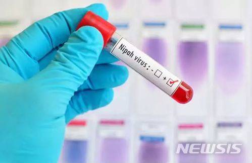 [뉴시스]인도 남부 케랄라주에서 니파 바이러스에 감염된 것으로 확인됐거나 의심되는 사망자 9명이 발생했다고 인도 보건 관리들이 21일 밝혔다. 니파 바이러스는 1999년 첫 발견된 이후 세계보건기구(WHO)가 앞으로 창궐 위험이 높은 10대 경계 질병 중 하나로 꼽은 질병으로 큰과일박쥐에 의해 사람에게로 전염되며 치사율이 70%에 이르는 반면 백신은 개발되지 못했다. <사진 출처 : NDTV> 2018.5.21