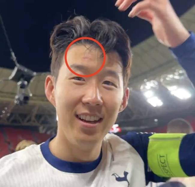 사진=토트넘 홋스퍼 SNS 캡쳐