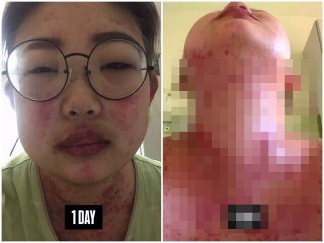 최준희./소셜미디어