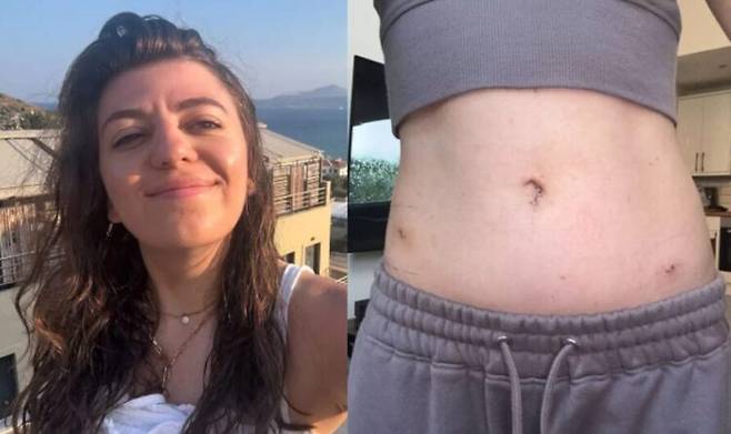 한 여성이 11년 동안 심각한 여성질환 증상을 겪어왔음에도 늘 '정상'이라는 의료진의 간과 탓에, 고통을 방치 당하다 마침내 자궁내막증을 진단받은 사연이 전해졌다. [사진=SNS]