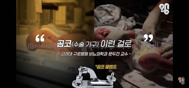 신생아 때 포경수술을 하면 작아진다