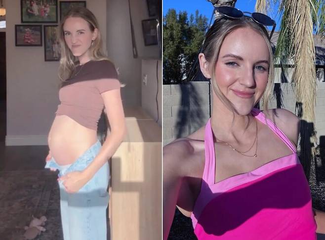 트림을 하지 못하는 희귀병을 앓는 미국의 한 여성 사연이 공개됐다. [사진=SNS]