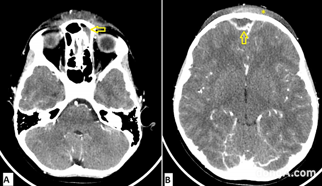 사진=Cureus 5월 호 캡처.