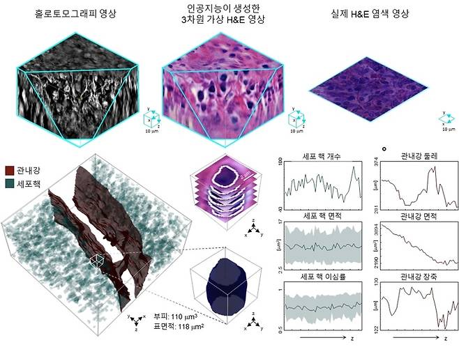 인공지능(AI) 기반 3차원 가상 H&E 염색 및 병리 조직 정량 분석 결과