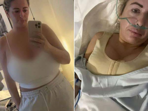 자라 암스트롱이 가슴 축소술을 받기 전(왼)과 후(오)의 모습./사진=더 선