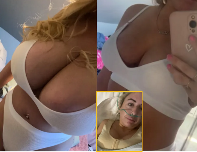 과도하게 큰 가슴으로 극심한 신체적·정신적 고통을 겪던 한 여성이, 자국 의료기관의 수술 거부로 결국 수천 킬로미터 떨어진 타국에서 가슴 축소술을 받은 사연을 공유했다. 좌측=J 컵 시절의 가슴. 우측=D컵으로 축소 후의 모습 [사진=SNS]