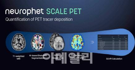 뉴로핏 스케일 팻 제품