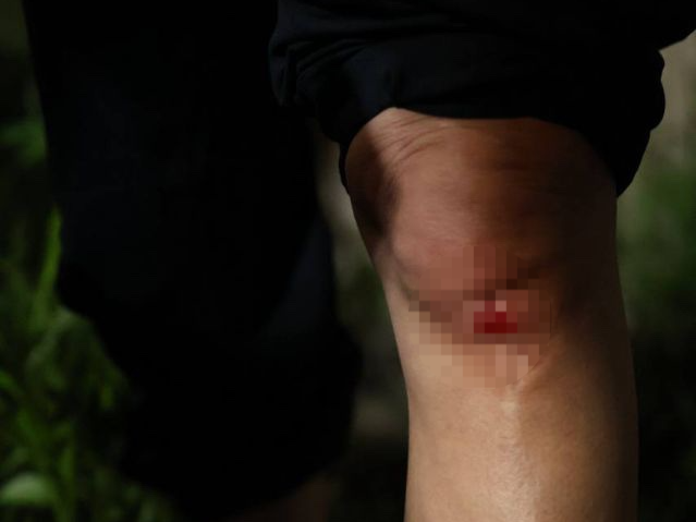 지난해 4월19일 별이(활동명)가 무릎을 꿇은 채로 파주시청 여성가족과 성매매집결지TF 소속 공무원의 바지를 잡고 끌려다가 무릎에 상처를 입은 모습. 주홍빛연대 차차 제공