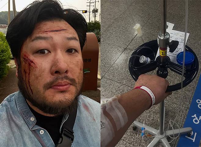 말라리아 감염 사실을 알렸던 배우 김대호(37)가 28일 자신의 인스타그램을 통해 무사히 퇴원했다는 근황을 전했다./사진=김대호 인스타그램