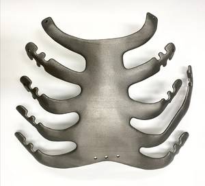 SLM 고속 공정기술로 제작한 맞춤형 인공 흉부 뼈